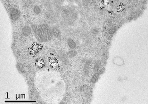 view of cell in electronic microscopy