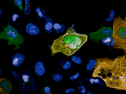 Visualization and quantification by MTBench technology of protein-protein interactions observed at Opera Phenix + in a cell line.