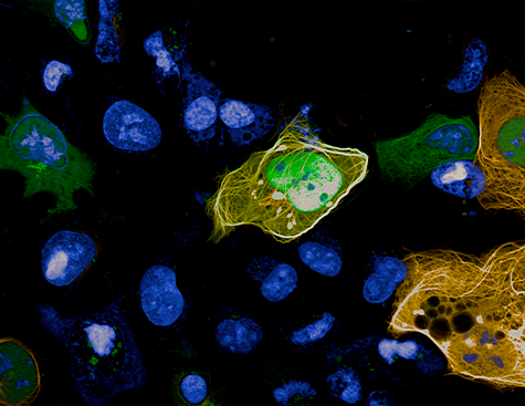 Visualization and quantification by MTBench technology of protein-protein interactions observed at Opera Phenix + in a cell line.