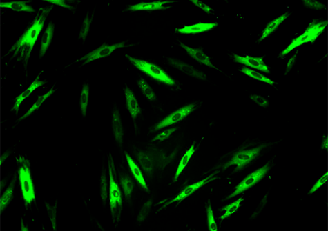 Image de cellules par imagerie issue de l'étude de la combinaison de 2 médicaments pour le traitement de la mucoviscidose et des myopathies