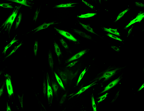Image de cellules par imagerie issue de l'étude de la combinaison de 2 médicaments pour le traitement de la mucoviscidose et des myopathies